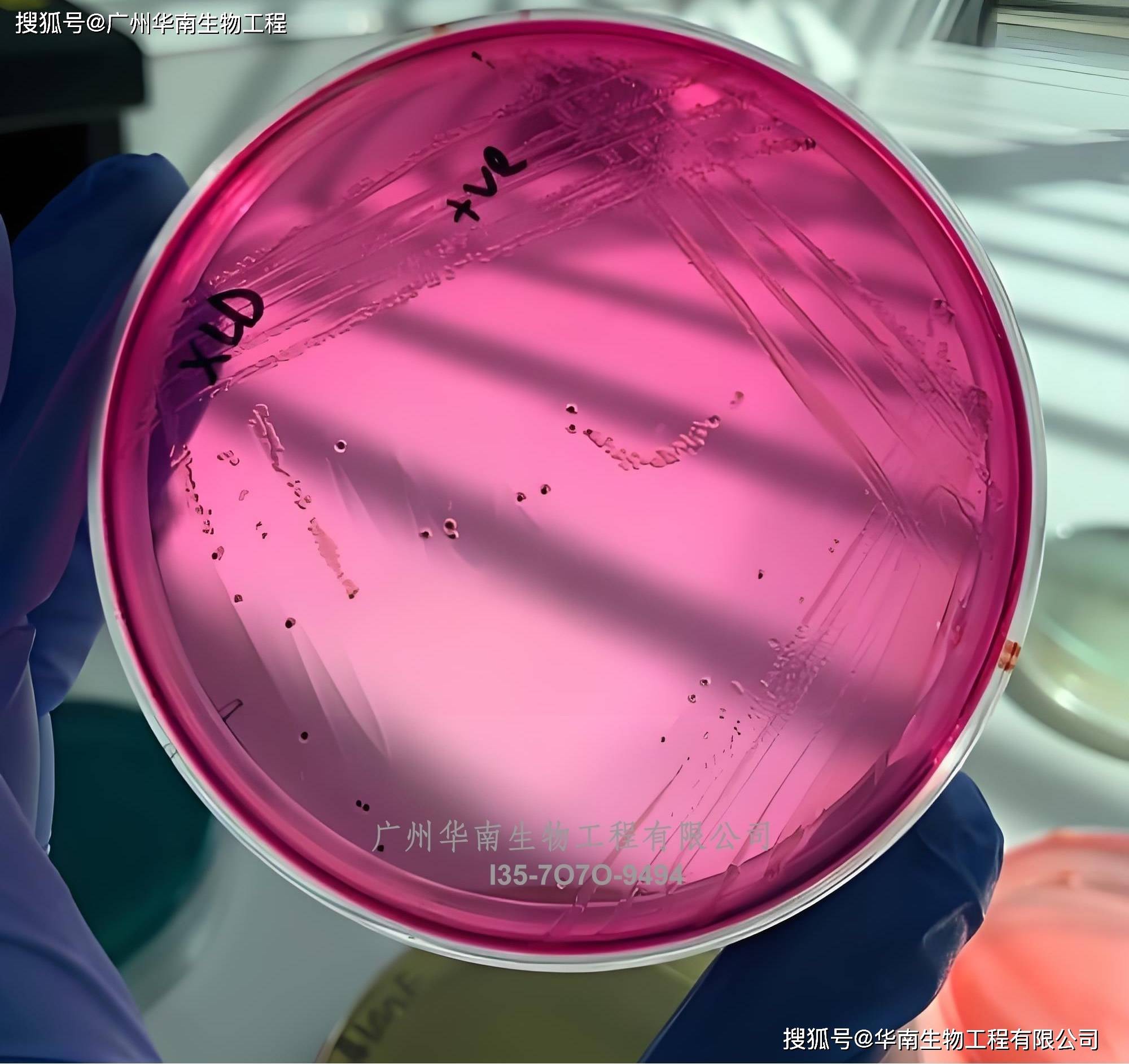 丹麦ssi中(zhōng)国官(guān)网中(zhōng)文版